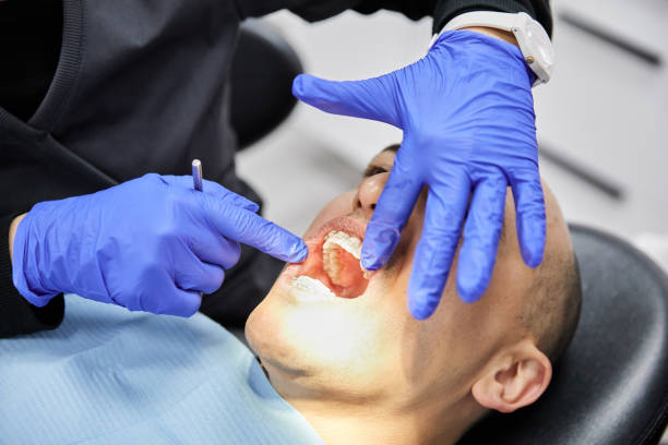 Best Dentist for Tooth Abscess  in Nashua, IA