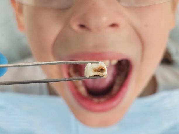 Best Tooth Pain Emergency Relief  in Nashua, IA